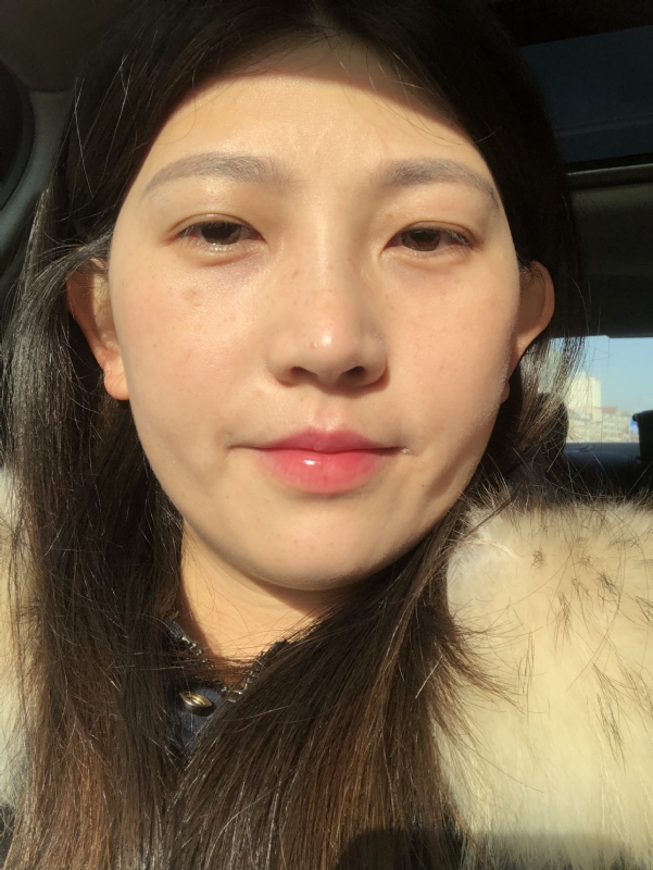 轻闭双眼的第一张照片--大连残疾人相亲网